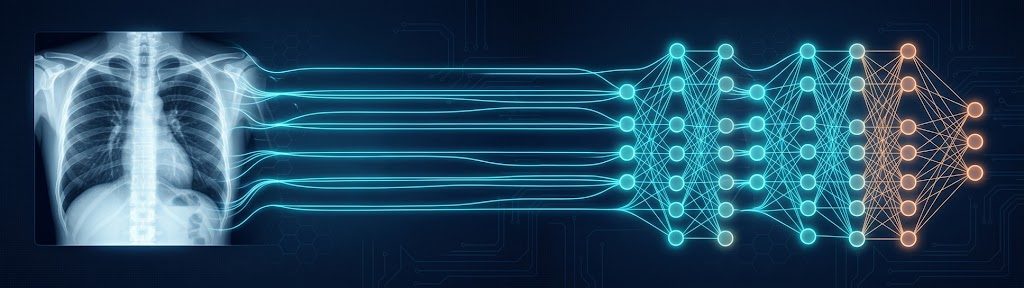 Chest X-ray classification banner
